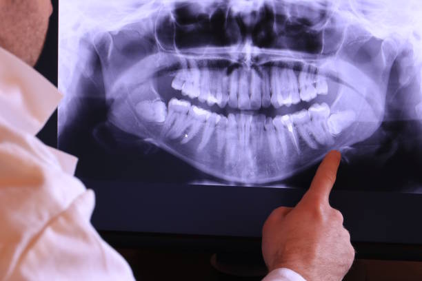 Best Emergency Treatment for Dental Infections or Abscesses in Miller Place, NY